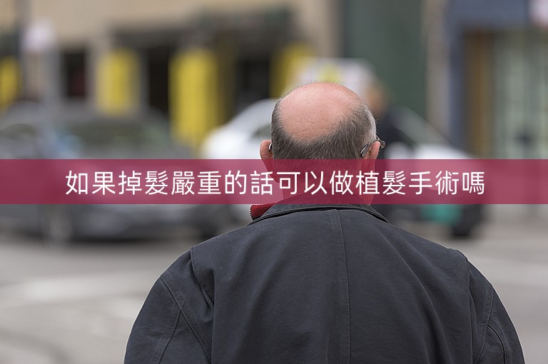 如果掉髮嚴重的話可以做植髮手術嗎 如果掉髮嚴重的話可以做植髮手術嗎