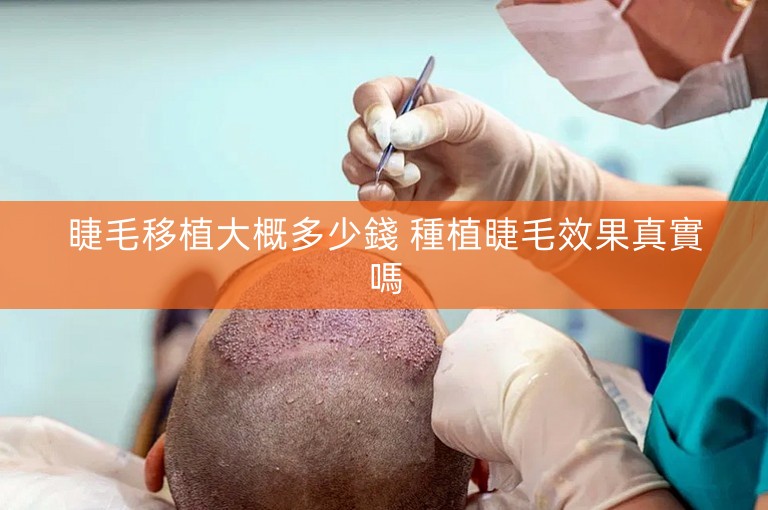 睫毛移植大概多少錢 種植睫毛效果真實嗎 睫毛移植大概多少錢 種植睫毛效果真實嗎