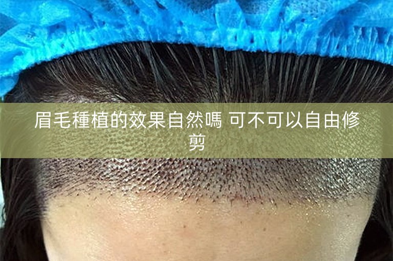 眉毛種植的效果自然嗎 可不可以自由修剪