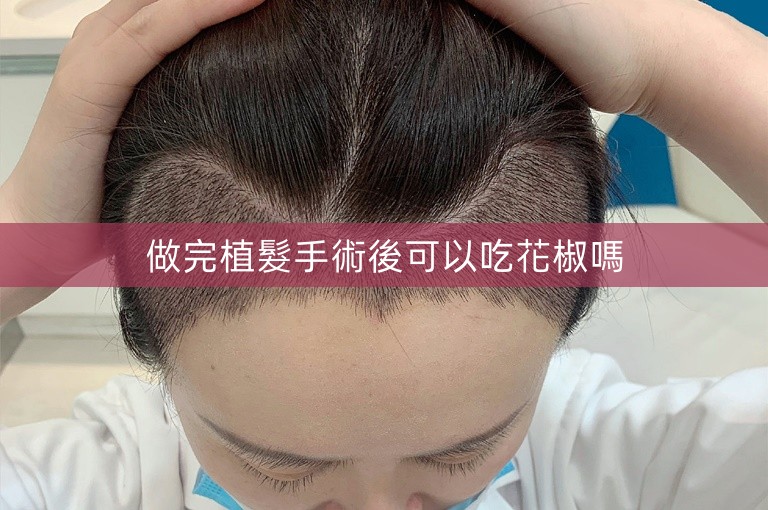做完植髮手術後可以吃花椒嗎
