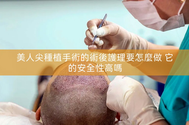 美人尖種植手術的術後護理要怎麼做 它的安全性高嗎