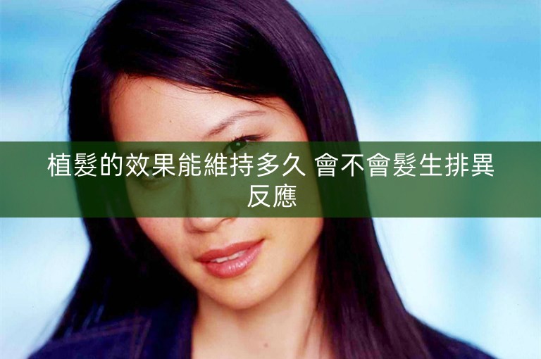 植髮的效果能維持多久 會不會髮生排異反應