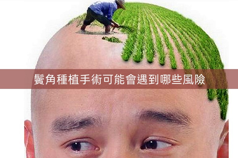 鬢角種植手術可能會遇到哪些風險