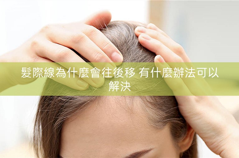 髮際線為什麼會往後移 有什麼辦法可以解決