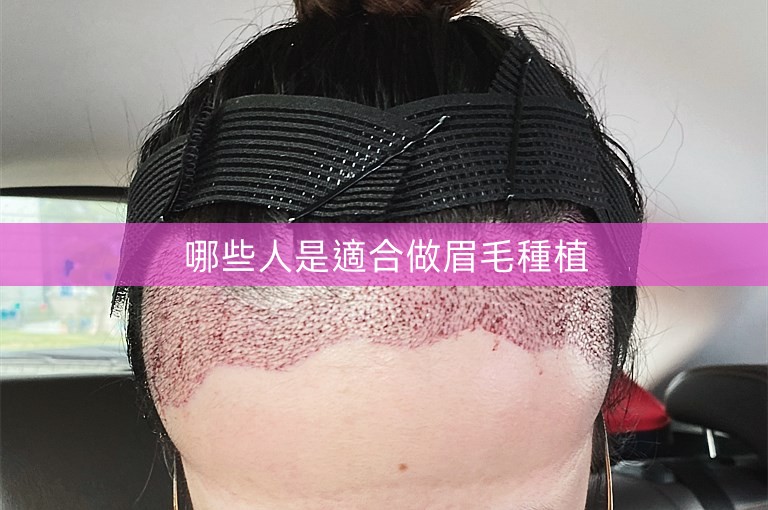 哪些人是適合做眉毛種植
