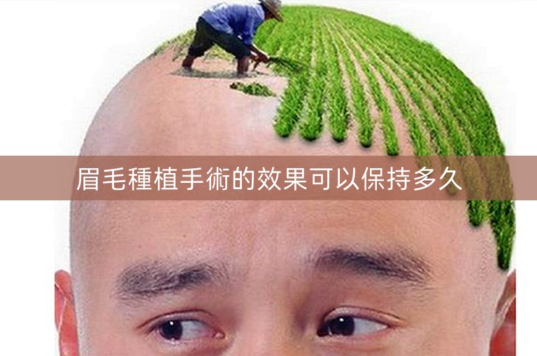眉毛種植手術的效果可以保持多久