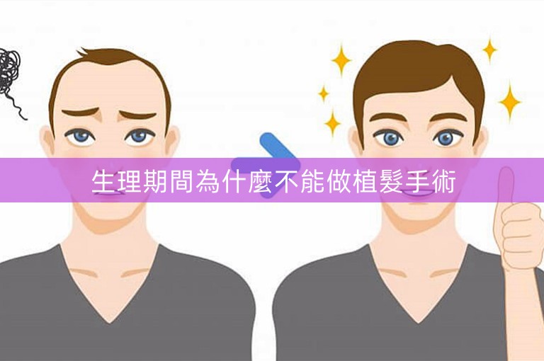 生理期間為什麼不能做植髮手術