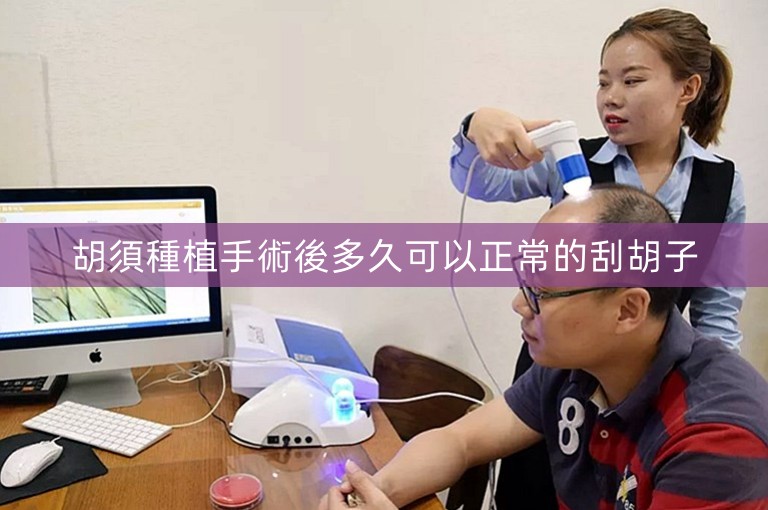 胡須種植手術後多久可以正常的刮胡子