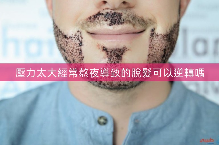 壓力太大經常熬夜導致的脫髮可以逆轉嗎