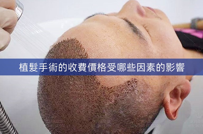 植髮手術的收費價格受哪些因素的影響