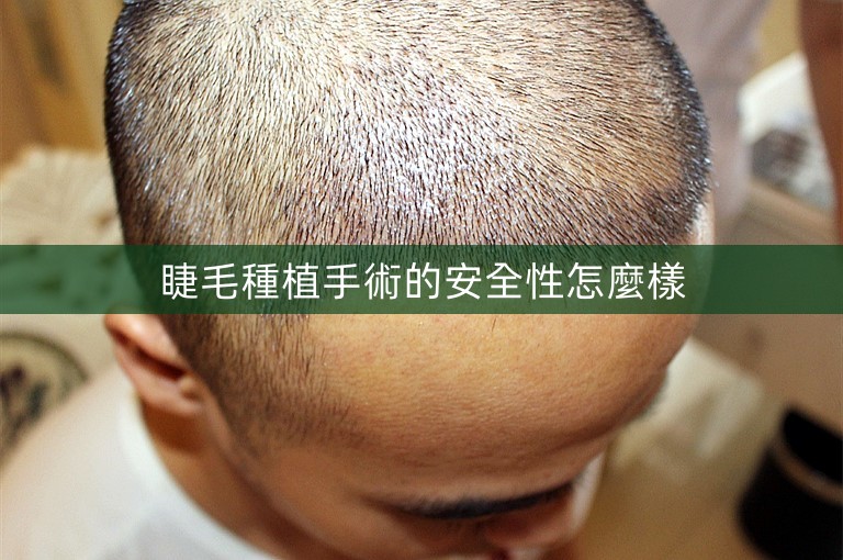睫毛種植手術的安全性怎麼樣