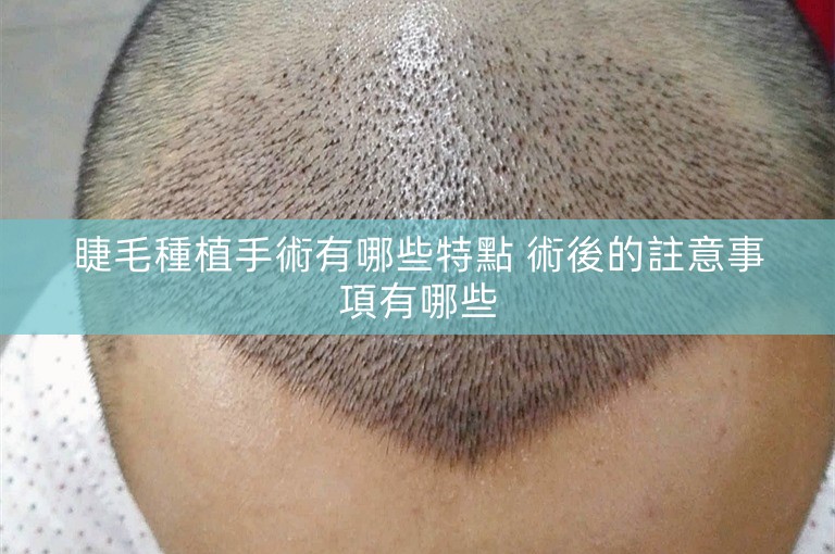 睫毛種植手術有哪些特點 術後的註意事項有哪些