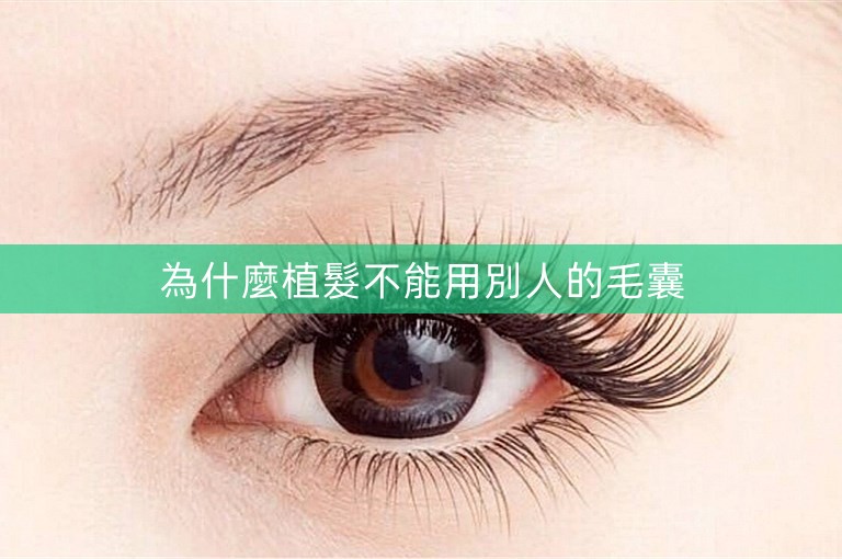 為什麼植髮不能用別人的毛囊
