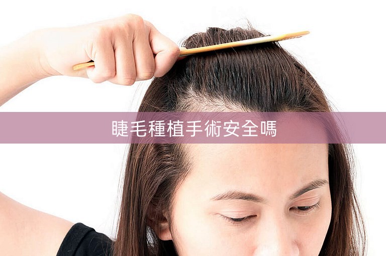 睫毛種植手術安全嗎