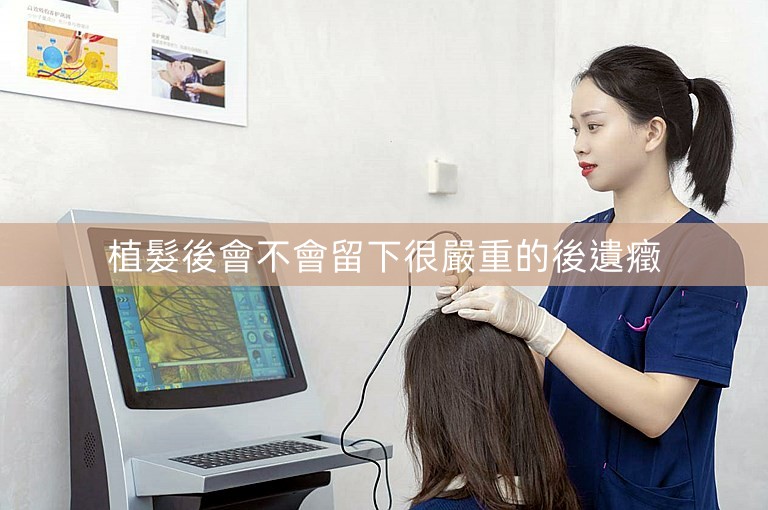 植髮後會不會留下很嚴重的後遺癥