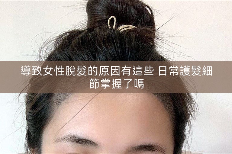 導致女性脫髮的原因有這些 日常護髮細節掌握了嗎
