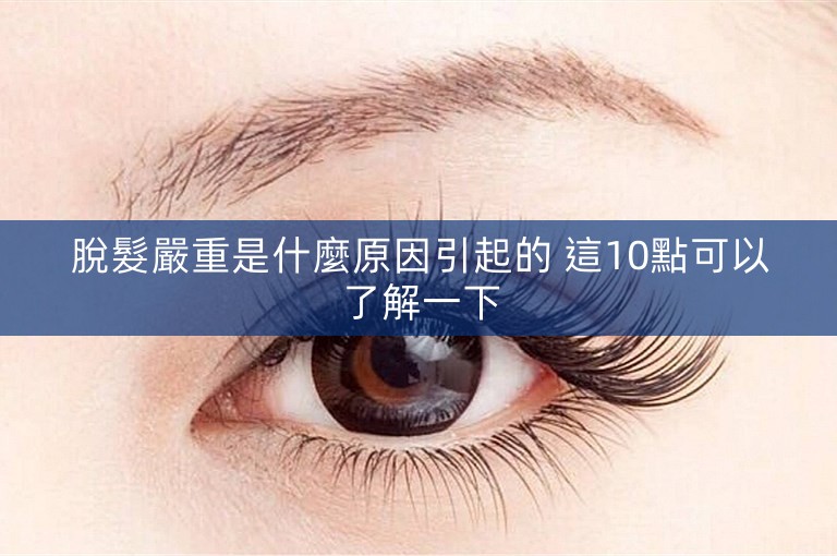 脫髮嚴重是什麼原因引起的 這10點可以了解一下