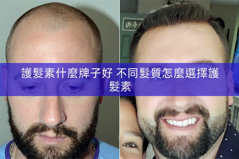 護髮素什麼牌子好 不同髮質怎麼選擇護髮素