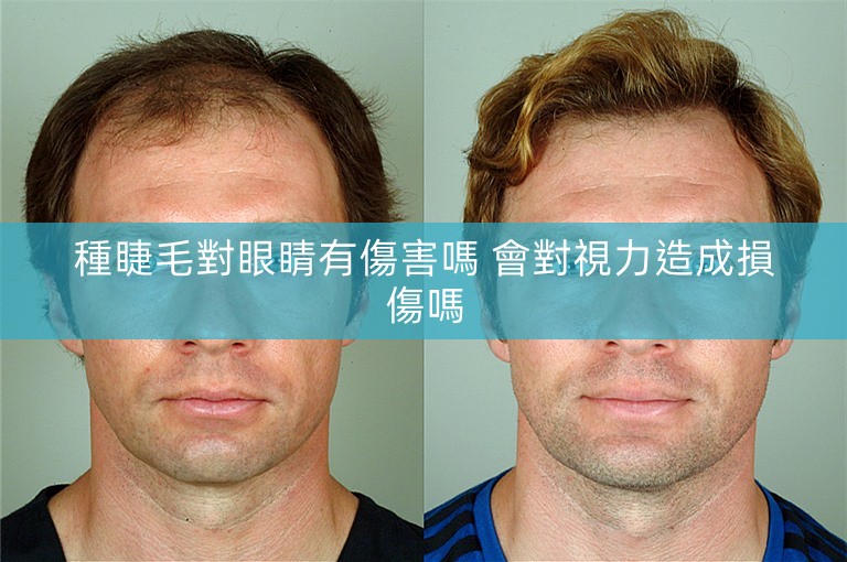 種睫毛對眼睛有傷害嗎 會對視力造成損傷嗎