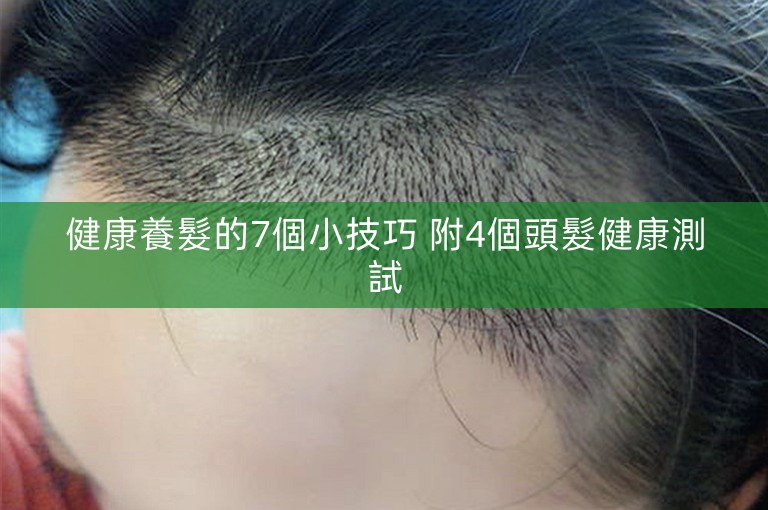 健康養髮的7個小技巧 附4個頭髮健康測試