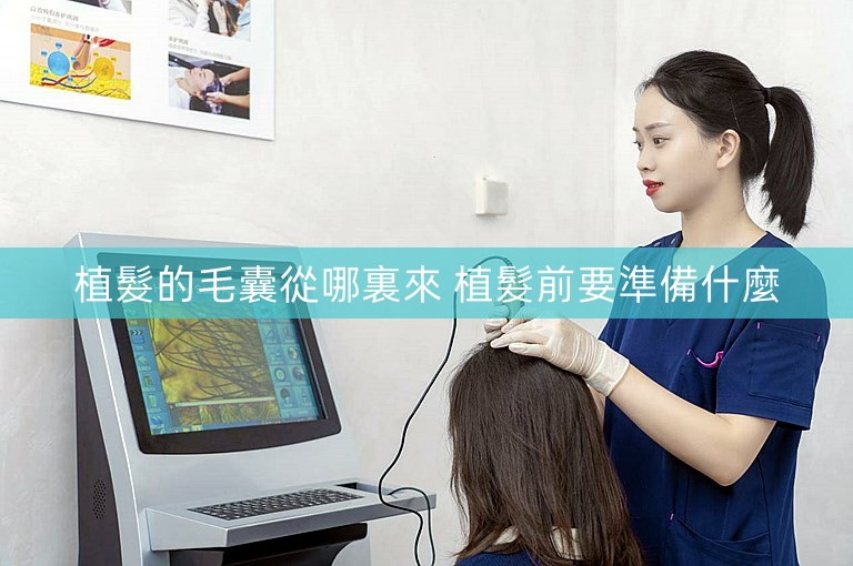 植髮的毛囊從哪裏來 植髮前要準備什麼