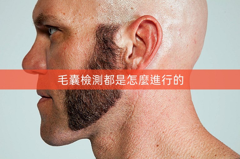 毛囊檢測都是怎麼進行的
