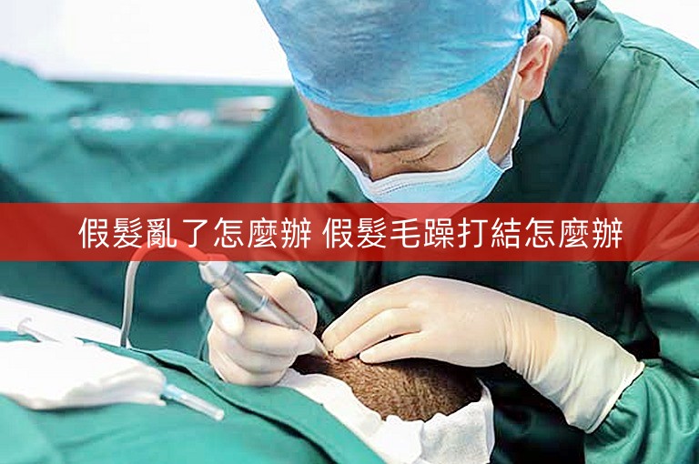 假髮亂了怎麼辦 假髮毛躁打結怎麼辦