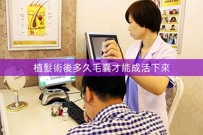 植髮術後多久毛囊才能成活下來