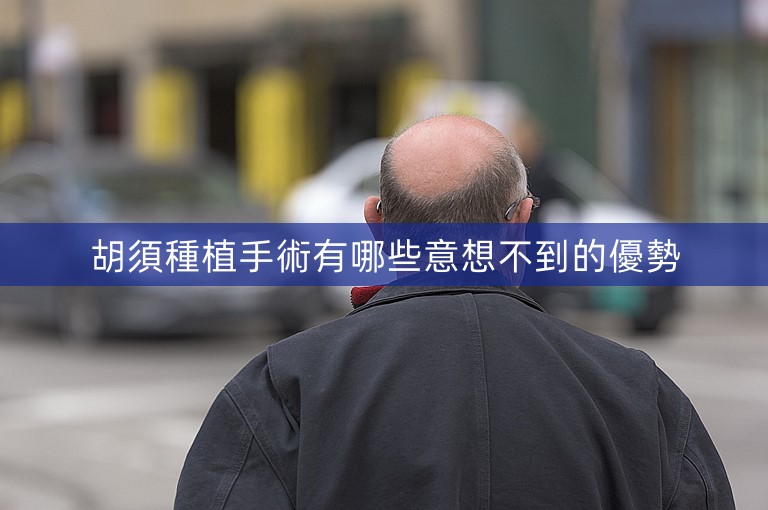 胡須種植手術有哪些意想不到的優勢