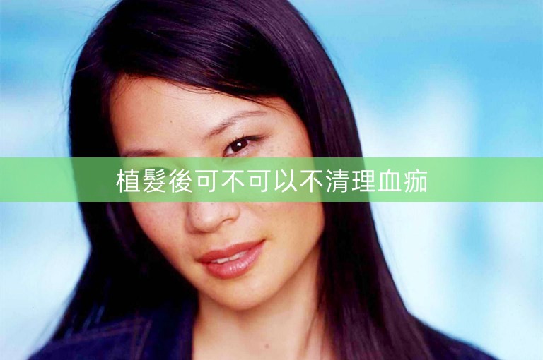 植髮後可不可以不清理血痂