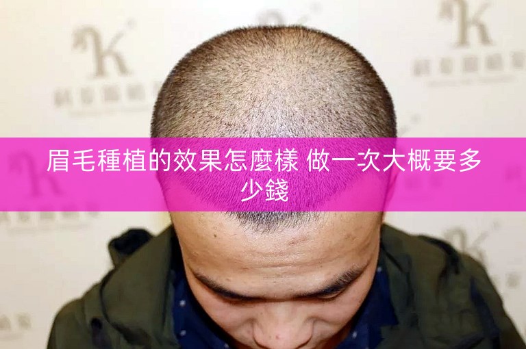 眉毛種植的效果怎麼樣 做一次大概要多少錢