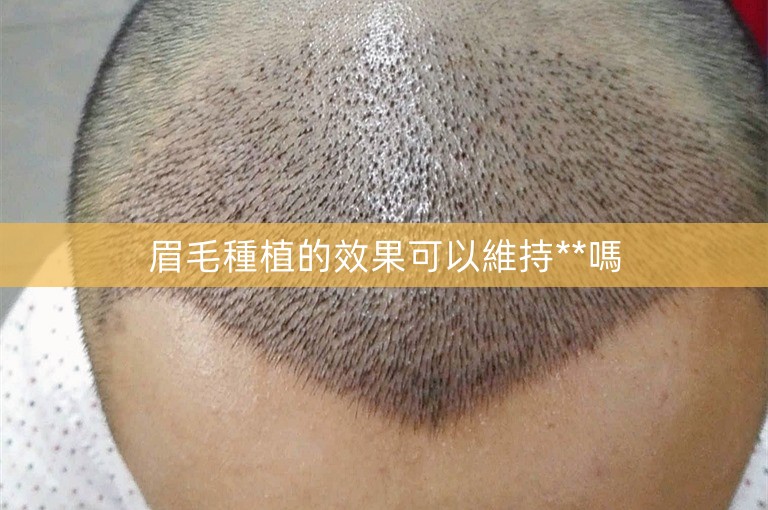 眉毛種植的效果可以維持**嗎