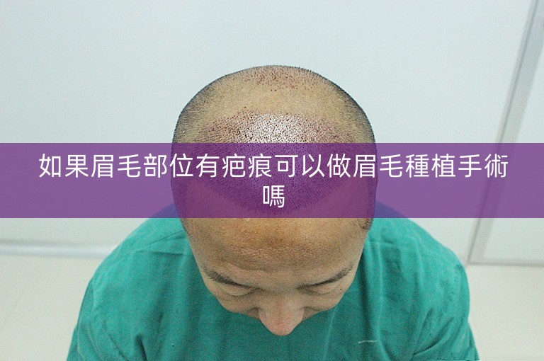 如果眉毛部位有疤痕可以做眉毛種植手術嗎