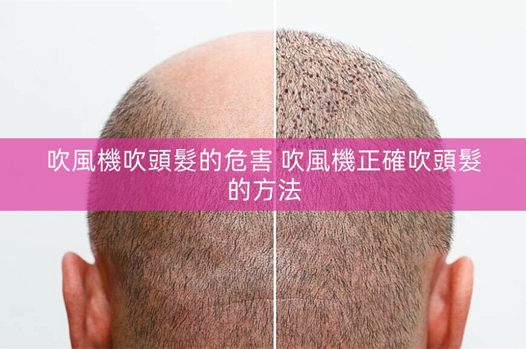 吹風機吹頭髮的危害 吹風機正確吹頭髮的方法