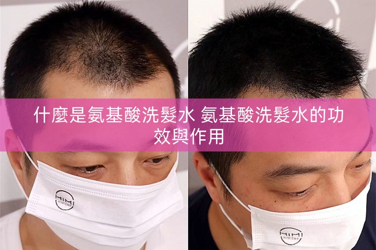 什麼是氨基酸洗髮水 氨基酸洗髮水的功效與作用