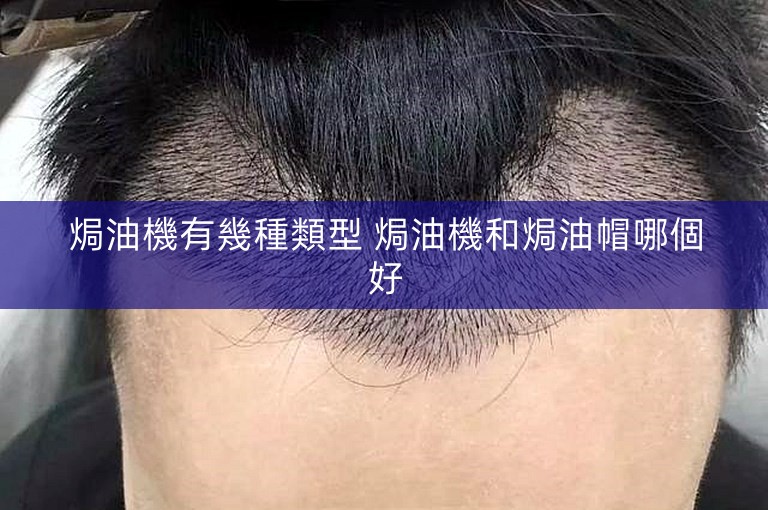 焗油機有幾種類型 焗油機和焗油帽哪個好