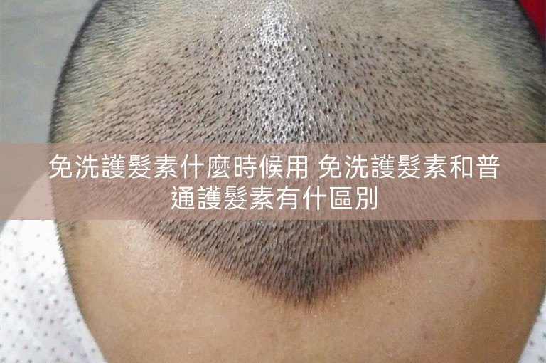 免洗護髮素什麼時候用 免洗護髮素和普通護髮素有什區別 免洗護髮素什麼時候用 免洗護髮素和普通護髮素有什區別