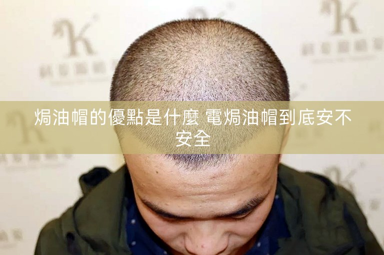 焗油帽的優點是什麼 電焗油帽到底安不安全