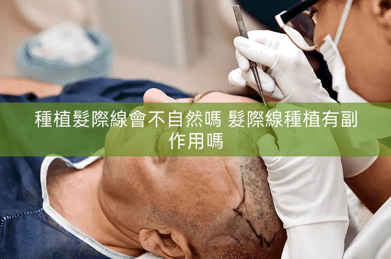 種植髮際線會不自然嗎 髮際線種植有副作用嗎