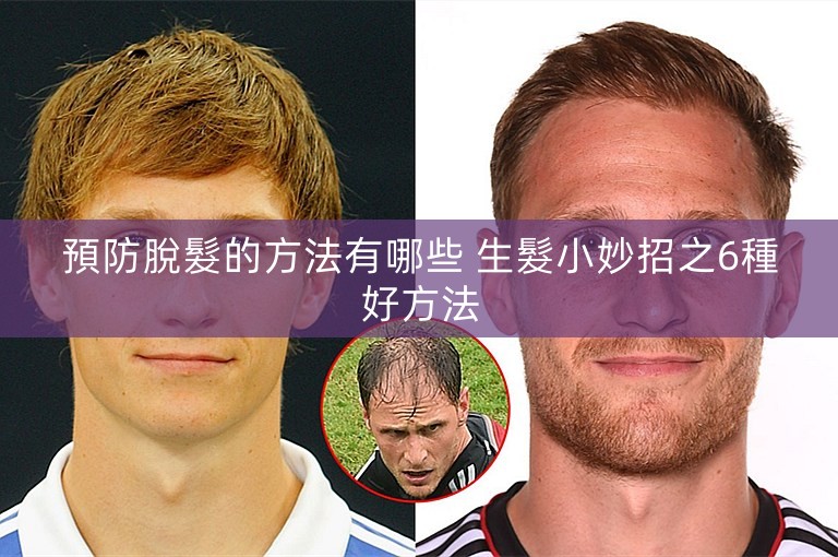 預防脫髮的方法有哪些 生髮小妙招之6種好方法