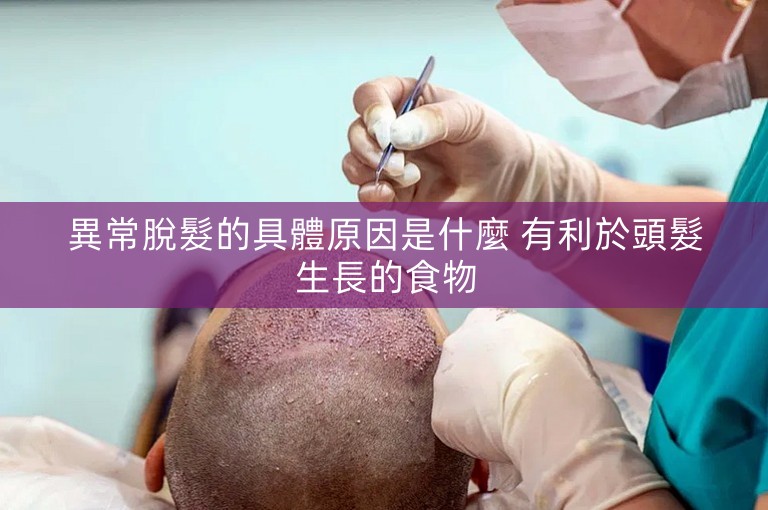 異常脫髮的具體原因是什麼 有利於頭髮生長的食物 異常脫髮的具體原因是什麼 有利於頭髮生長的食物