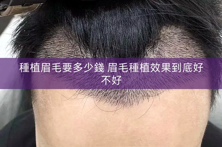 種植眉毛要多少錢 眉毛種植效果到底好不好