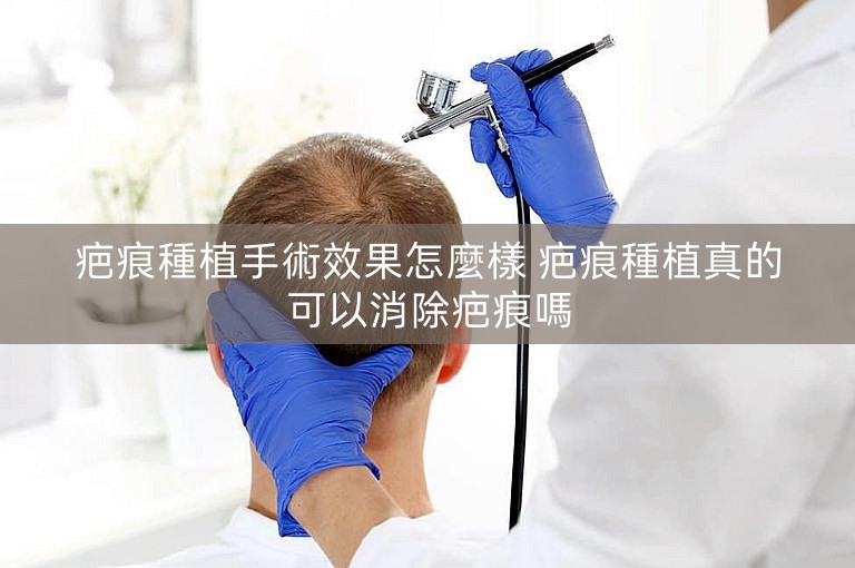 疤痕種植手術效果怎麼樣 疤痕種植真的可以消除疤痕嗎