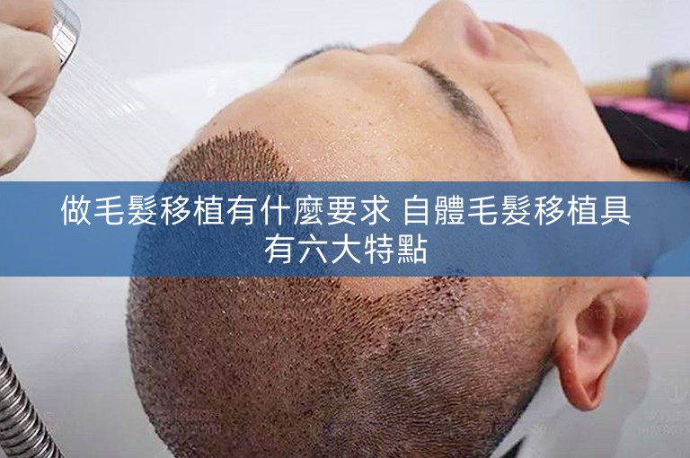 做毛髮移植有什麼要求 自體毛髮移植具有六大特點