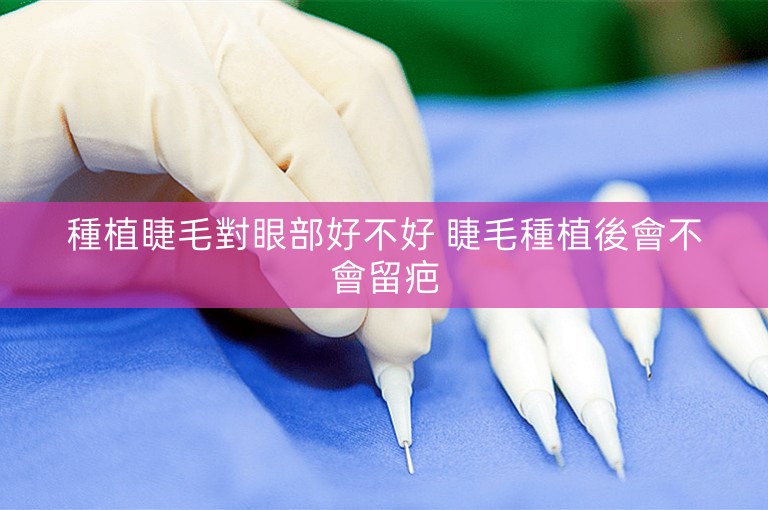 種植睫毛對眼部好不好 睫毛種植後會不會留疤