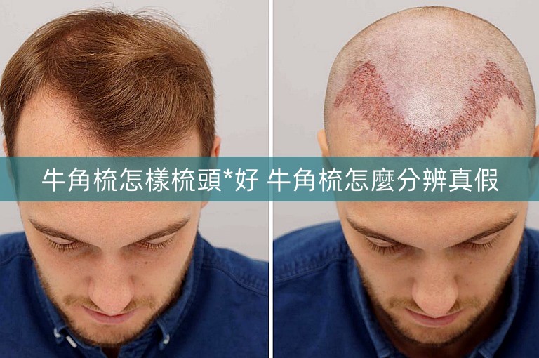 牛角梳怎樣梳頭*好 牛角梳怎麼分辨真假