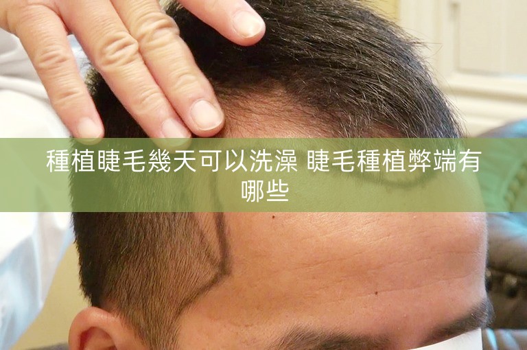 種植睫毛幾天可以洗澡 睫毛種植弊端有哪些
