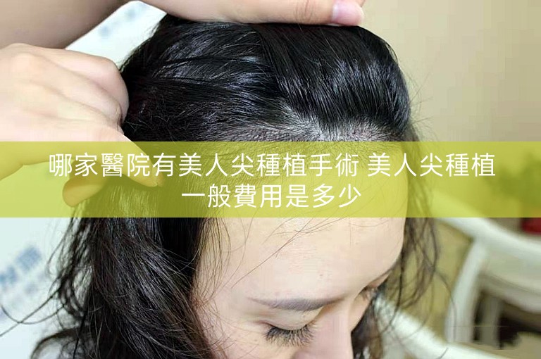 哪家醫院有美人尖種植手術 美人尖種植一般費用是多少