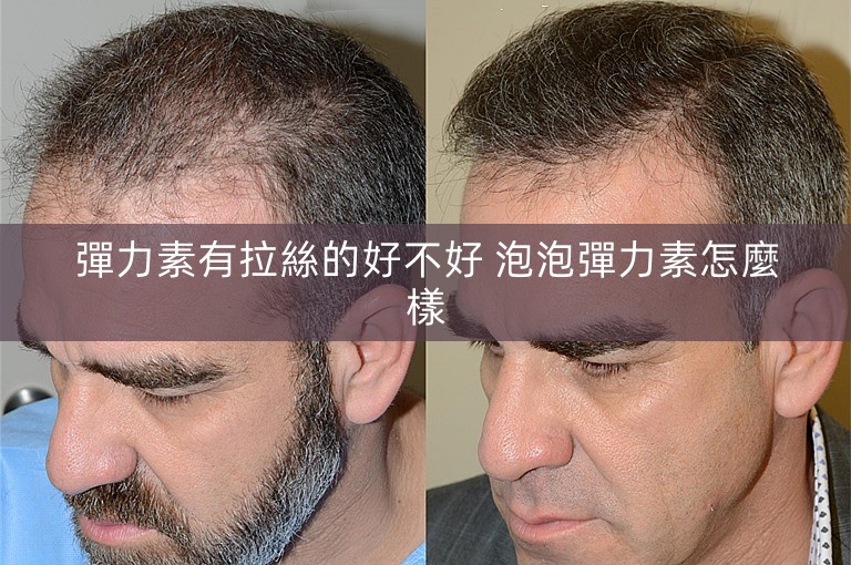 彈力素有拉絲的好不好 泡泡彈力素怎麼樣