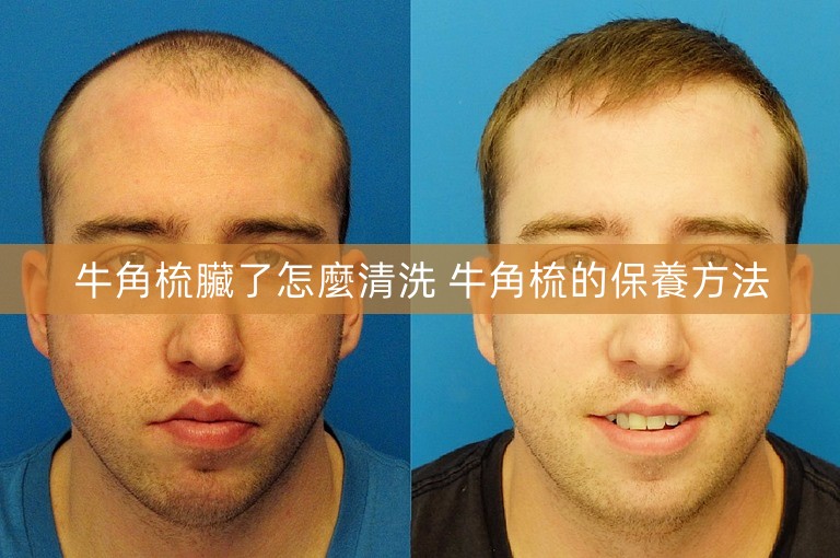 牛角梳臟了怎麼清洗 牛角梳的保養方法
